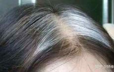 白发越长越多,原因竟然在这里