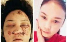 2015年洛阳权健传销者因去天津参加年会遭遇车祸调查