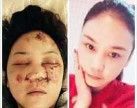 2015年洛阳权健传销者因去天津参加年会遭遇车祸调查