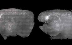 治愈老年痴呆新希望：光声诱导大脑震荡，零副作用恢复记忆与认知