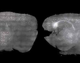 治愈老年痴呆新希望：光声诱导大脑震荡，零副作用恢复记忆与认知
