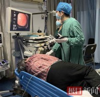 95岁老人被鱼刺卡喉,医生内镜下10分钟取出